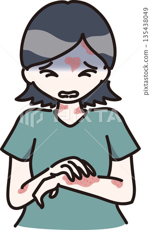 Illustration of a woman with hives allergy symptoms Illustration of a woman with hives allergy symptoms 135438049
