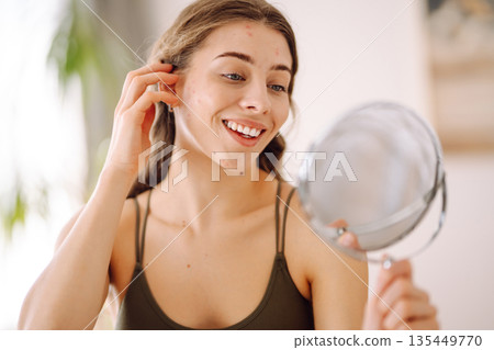 Young woman with problem skin looking into mirror. Concept of acne therapy, scars 135449770