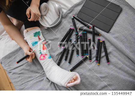 Woman hands drawing on broken leg cast. Unrecognizable girl draws with felt tip pens on orthopedic cast. Bored girl with broken leg playing at home during rehabilitation. Accident injury fracture Woman hands drawing on broken leg cast. Unrecognizable girl draws with felt tip pens on orthopedic cast. Bored girl with broken leg playing at home during rehabilitation. Accident injury fracture 135449947