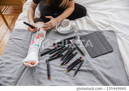 Woman hands drawing on broken leg cast. Unrecognizable girl draws with felt tip pens on orthopedic cast. Bored girl with broken leg playing at home during rehabilitation. Accident injury fracture 135449948