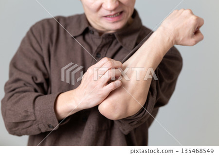 一位中年男子飽受皮膚乾燥、搔癢的困擾。 一位中年男子飽受皮膚乾燥、搔癢的困擾。 135468549