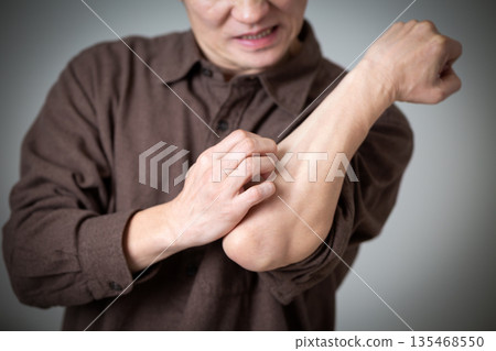 一位中年男子飽受皮膚乾燥、搔癢的困擾。 135468550