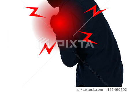Shoulder pain, frozen shoulder, periarthritis of the shoulder, adhesive capsulitis of the shoulder Shoulder pain, frozen shoulder, periarthritis of the shoulder, adhesive capsulitis of the shoulder 135469592