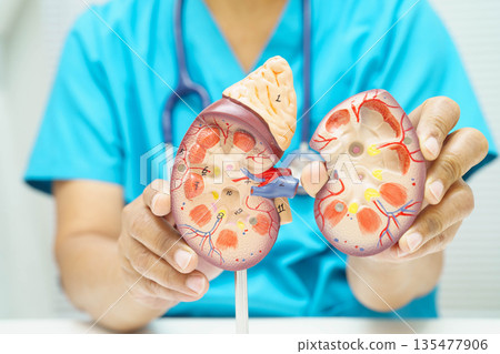 Chronic kidney disease, doctor with model for treatment urinary system, urology, Estimated glomerular filtration rate eGFR. Chronic kidney disease, doctor with model for treatment urinary system, urology, Estimated glomerular filtration rate eGFR. 135477906