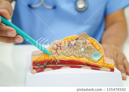 doctor holding female breast human anatomy model. doctor holding female breast human anatomy model. 135478592