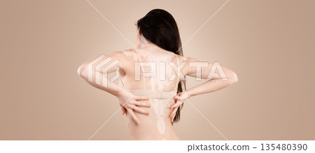 Vitiligo Skin. Rear View Of Young Woman With Body Depigmentation Posing In Underwear Over Beige Background In Studio, Skinny Female With Autoimmune Disorder Holding Hands On Back, Copy Space Vitiligo Skin. Rear View Of Young Woman With Body Depigmentation Posing In Underwear Over Beige Background In Studio, Skinny Female With Autoimmune Disorder Holding Hands On Back, Copy Space 135480390