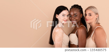 Different Beauty. Three Body Positive Females In Underwear Posing Over Beige Studio Background, Plus Size, Black And Lady With Vitiligo Skin Disorder Standing Together, Looking And Smiling At Camera 135480575