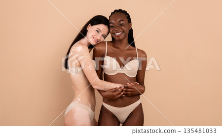 Diverse Beauty. Portrait Of Two Beautiful Women With Different Skin Types In Underwear Posing Together, Happy Young Black Female And Lady With Vitiligo Skin Standing Over Beige Background, Copy Space Diverse Beauty. Portrait Of Two Beautiful Women With Different Skin Types In Underwear Posing Together, Happy Young Black Female And Lady With Vitiligo Skin Standing Over Beige Background, Copy Space 135481033