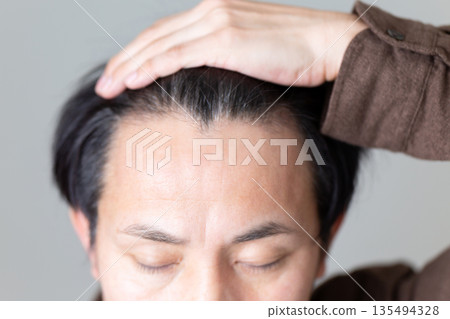 中年男性的髮際線 中年男性的髮際線 135494328