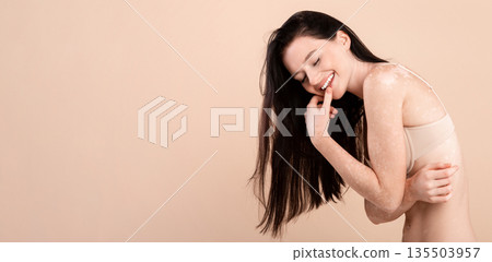 Body Acceptance. Portrait Of Happy Beautiful Lady With Vitiligo Skin Wearing Underwear, Smiling Young Skinny Female With White Pale Patches On Her Body Posing Over Beige Background, Copy Space Body Acceptance. Portrait Of Happy Beautiful Lady With Vitiligo Skin Wearing Underwear, Smiling Young Skinny Female With White Pale Patches On Her Body Posing Over Beige Background, Copy Space 135503957