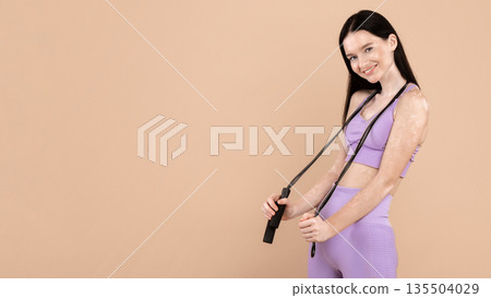 Sport For Every Body. Beautiful Woman With Vitiligo Skin Holding Skipping Rope Posing In Sportswear Over Beige Studio Background, Fit Young Female Ready For Training, Smiling At Camera, Copy Space 135504029