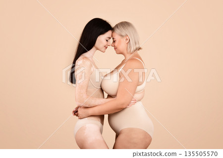 Side View Shot Of Two Body Positive Ladies Standing In Underwear, Young Plus Size Female And Woman With Vitiligo Skin Disorder Embracing And Touching Foreheads On Beige Studio Background, Copy Space 135505570