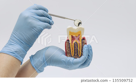 Gloved hands examining a tooth cross section model with dental mirror, showing internal tooth structure for dentistry education Gloved hands examining a tooth cross section model with dental mirror, showing internal tooth structure for dentistry education 135509752