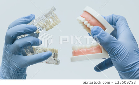 Comparison of dental prosthetic models in hands Comparison of dental prosthetic models in hands 135509758