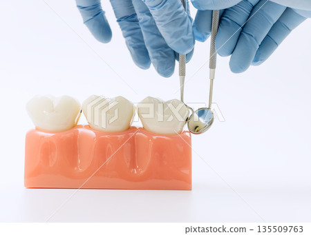 Dental professional with gloves holding mirror and probe tools over a healthy tooth model for inspection and training purposes. Dental professional with gloves holding mirror and probe tools over a healthy tooth model for inspection and training purposes. 135509763
