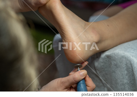 Close-up of electronic foot file machine. Skin care tool for removing calluses and dry skin at home. Close-up of electronic foot file machine. Skin care tool for removing calluses and dry skin at home. 135514036