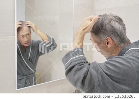 Senior man with hair problems Senior man with hair problems 135530263