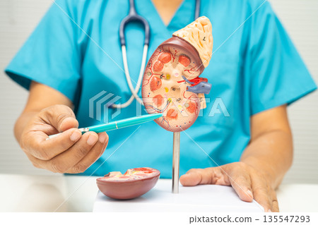 Chronic kidney disease, doctor with model for treatment urinary system, urology, Estimated glomerular filtration rate eGFR. 135547293