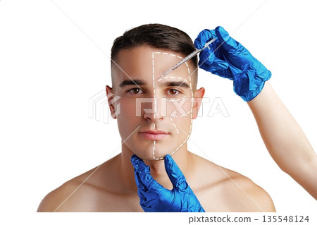 Man receives cosmetic procedure in a clinic with markings on his face Man receives cosmetic procedure in a clinic with markings on his face 135548124