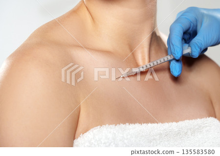 Procedure taking place on a person's collarbone area during a medical treatment session 135583580