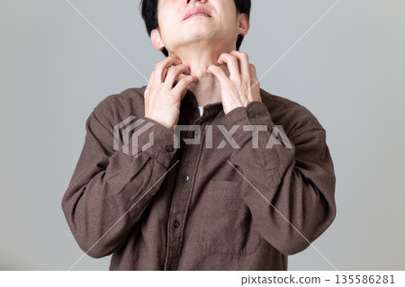 一位中年男子飽受皮膚乾燥、搔癢的困擾。 一位中年男子飽受皮膚乾燥、搔癢的困擾。 135586281