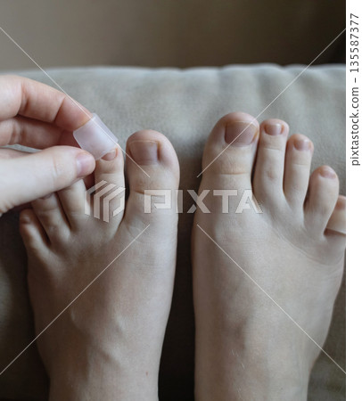 Silicone toe sleeve or cap. Woman puts on protective cover on little toe. Fights corns, prevents blisters and ingrown toenails Silicone toe sleeve or cap. Woman puts on protective cover on little toe. Fights corns, prevents blisters and ingrown toenails 135587377