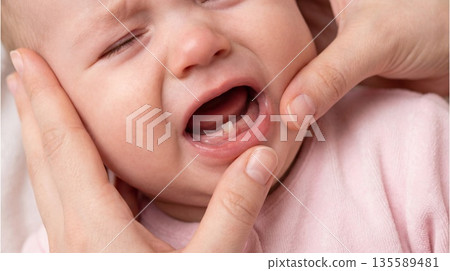 Baby with crying face receives comfort from adult during a teething moment at home in daytime 135589481