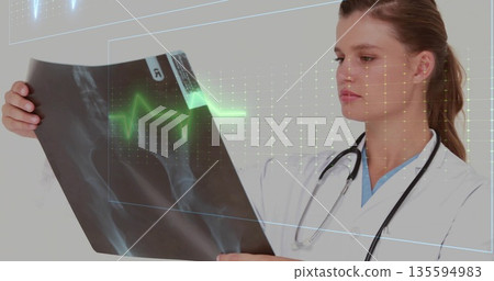 Female doctor in scrubs stethoscope examining X-ray film in lab with ECG grid overlays, copy space Female doctor in scrubs stethoscope examining X-ray film in lab with ECG grid overlays, copy space 135594983