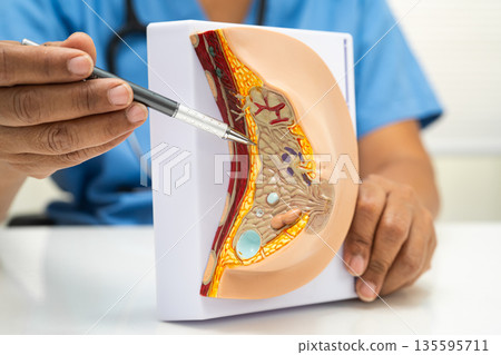 doctor holding female breast human anatomy model. 135595711