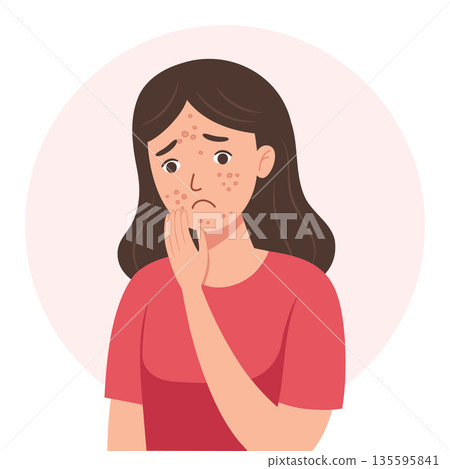 Acne. Unhappy woman with acne and pimples on her face. Irritated facial skin. Healthcare and medicine illustration. Acne. Unhappy woman with acne and pimples on her face. Irritated facial skin. Healthcare and medicine illustration. 135595841