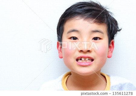 Regeneration from deciduous teeth to permanent teeth Regeneration from deciduous teeth to permanent teeth 135611278