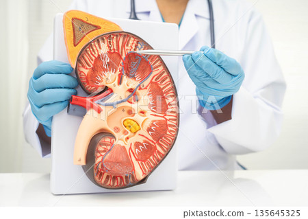 Chronic kidney disease, doctor with model for treatment urinary system, urology, Estimated glomerular filtration rate eGFR. Chronic kidney disease, doctor with model for treatment urinary system, urology, Estimated glomerular filtration rate eGFR. 135645325