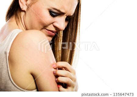 Woman scratching her arm 135647473