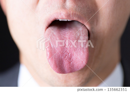中年男子的舌頭 中年男子的舌頭 135662351