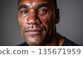 Close-up portrait of a man with bruises on his face, genuine human emotions, strength after a struggle, realistic studio lighting 135671959