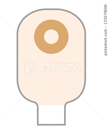 造口裝置示意圖 135679606