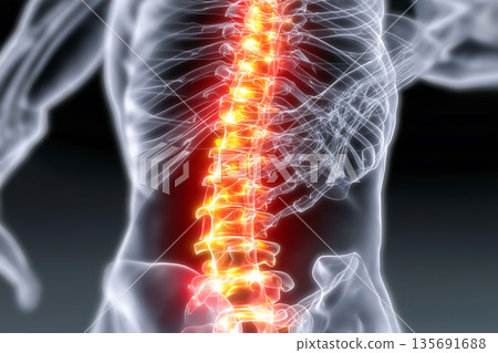 Image of the causes of lumbago and lower back pain | Visual representation of the spine and nerves Image of the causes of lumbago and lower back pain | Visual representation of the spine and nerves 135691688