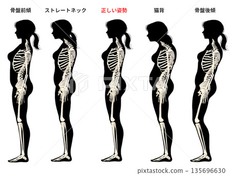 骨骼模型的正確姿勢，駝背，頸部挺直，骨盆前傾，骨盆順序輪廓 135696630