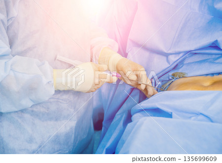 Arthroscope surgery. Orthopedic surgeons in teamwork in the operating room 135699609