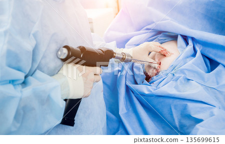 Arthroscope surgery. Orthopedic surgeons in teamwork in the operating room Arthroscope surgery. Orthopedic surgeons in teamwork in the operating room 135699615