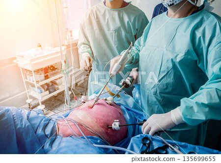 Process of gynecological surgery operation using laparoscopic equipment. Process of gynecological surgery operation using laparoscopic equipment. 135699655