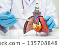 Pneumonia, lung cancer, Asian doctor holding human model. 135708848