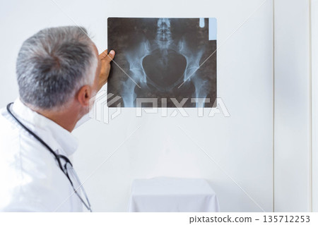 Senior male doctor holding pelvic X-ray film against wall in exam room wearing coat and stethoscope Senior male doctor holding pelvic X-ray film against wall in exam room wearing coat and stethoscope 135712253