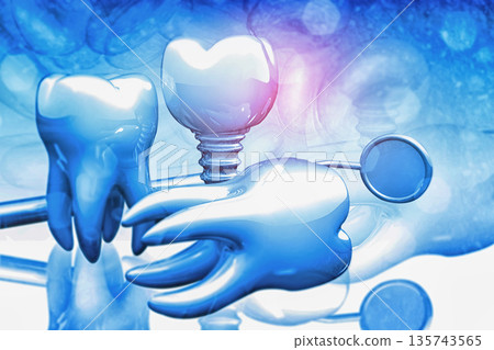 Dental implants concept background 135743565