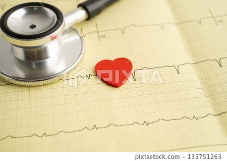 Stethoscope on electrocardiogram ECG, heart wave, heart attack, cardiogram report. Stethoscope on electrocardiogram ECG, heart wave, heart attack, cardiogram report. 135751263