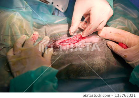Surgical Operation On Patient With Sterile Gloves, Drapes, Visible Incision, And Team In Operating Room Surgical Operation On Patient With Sterile Gloves, Drapes, Visible Incision, And Team In Operating Room 135763321