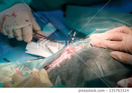Surgeons Perform Surgical Procedure With Sterile Tools in Operating Room Surgeons Perform Surgical Procedure With Sterile Tools in Operating Room 135763324