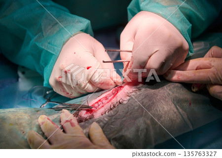 Surgeons Perform Precise Surgical Procedure With Scalpels And Forceps During Operation Under Sterile Lighting In Operating Room Surgeons Perform Precise Surgical Procedure With Scalpels And Forceps During Operation Under Sterile Lighting In Operating Room 135763327