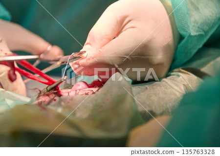 Surgeons Perform Precision Operation With Sterile Tools In The Operating Room 135763328
