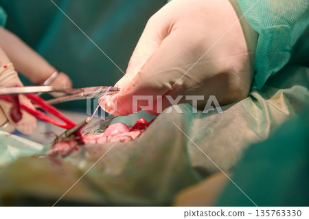 Surgeons In Green Scrubs Performing Detailed Surgical Procedure In Operating Room Surgeons In Green Scrubs Performing Detailed Surgical Procedure In Operating Room 135763330